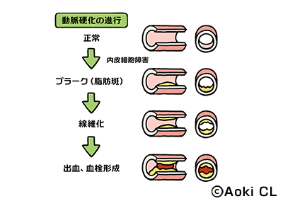 消化器症状とは